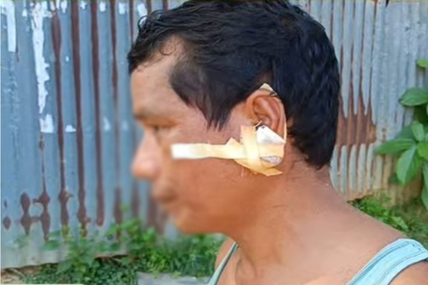 Son Allegedly Attacks Father with Sharp Weapon Over Money for Drugs